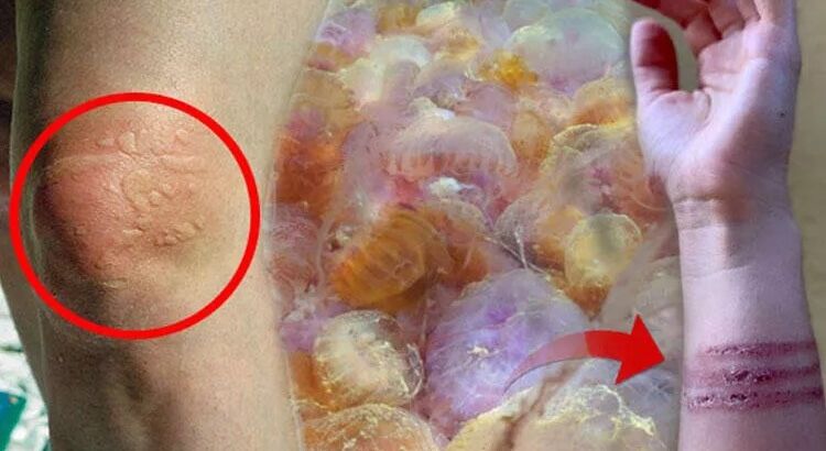 Появятся ли в Турции ядовитые медузы из соседних побережий?