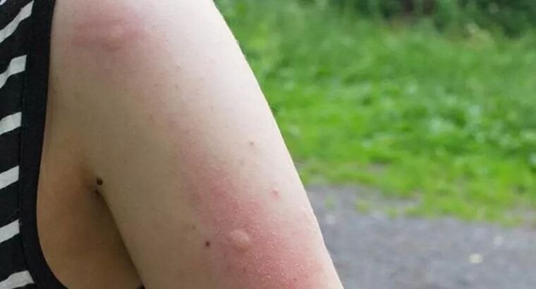 В этих округах Стамбула наблюдается нашествие комаров