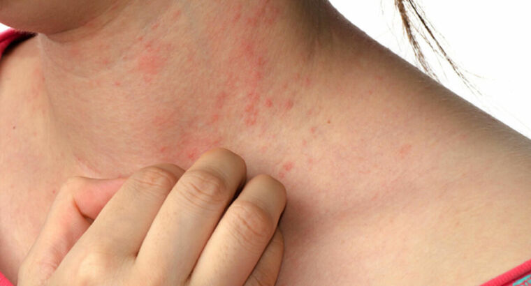 Осторожно: чесотка