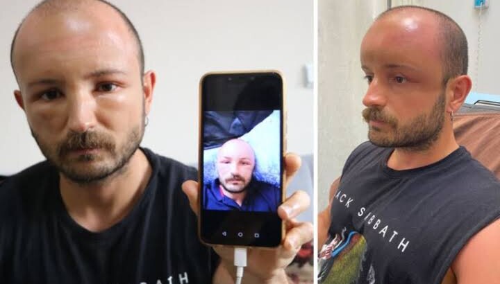 Будьте осторожны: отёк головы