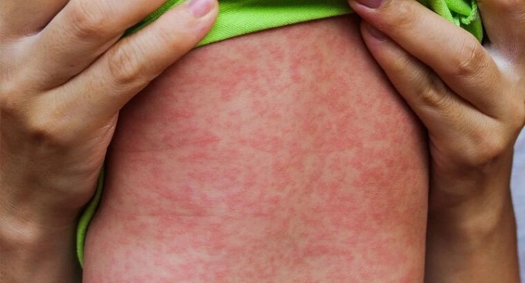 Предупреждение от Научного Комитета