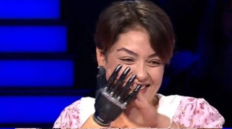 Девушка выиграла в программе «Кто хочет стать миллионером» не только денежный приз, но и протез