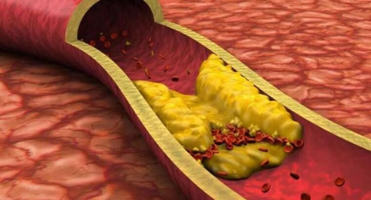 Эти продукты очищают организм