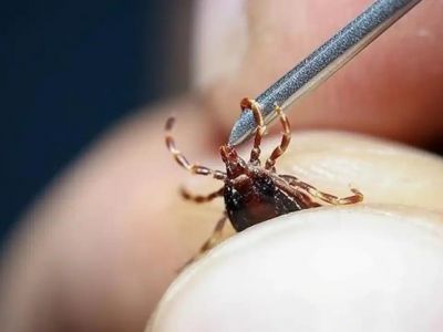 Женщина пришла в больницу — а у неё на животе оказалась клещ!