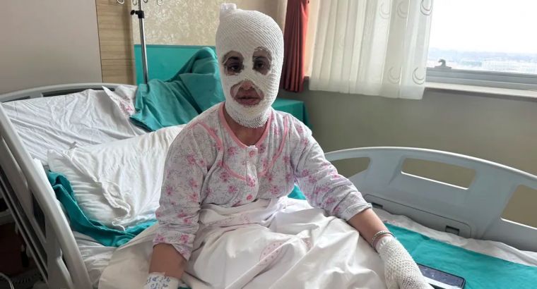 Во время подготовки к ифтару в Турции взорвалась скороварка: молодая женщина получила серьёзные ожоги