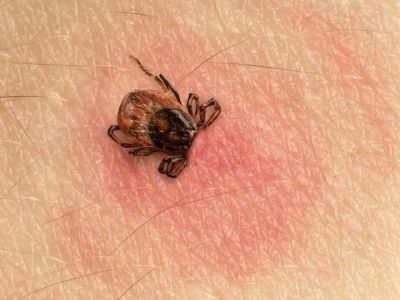 Клещи снова становятся угрозой в Турции: специалисты предупреждают о начале сезона 🕷️