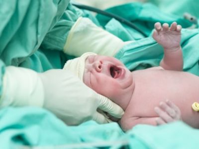 В Турции начали наказывать врачей за большое число кесаревых сечений